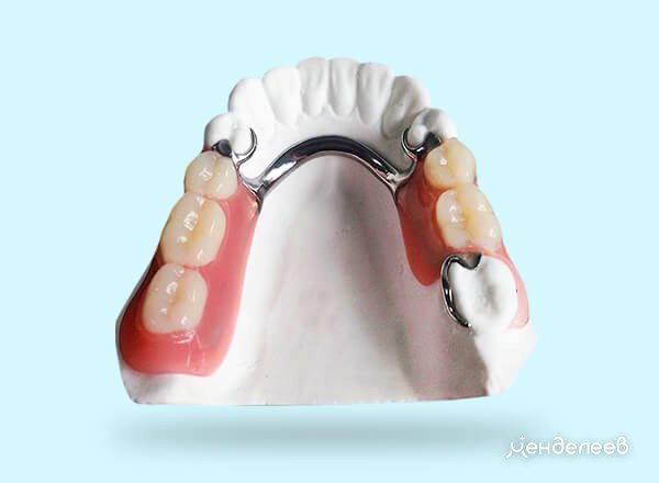 бюгельные зубные протезы на нижнюю челюсть отзывы фото