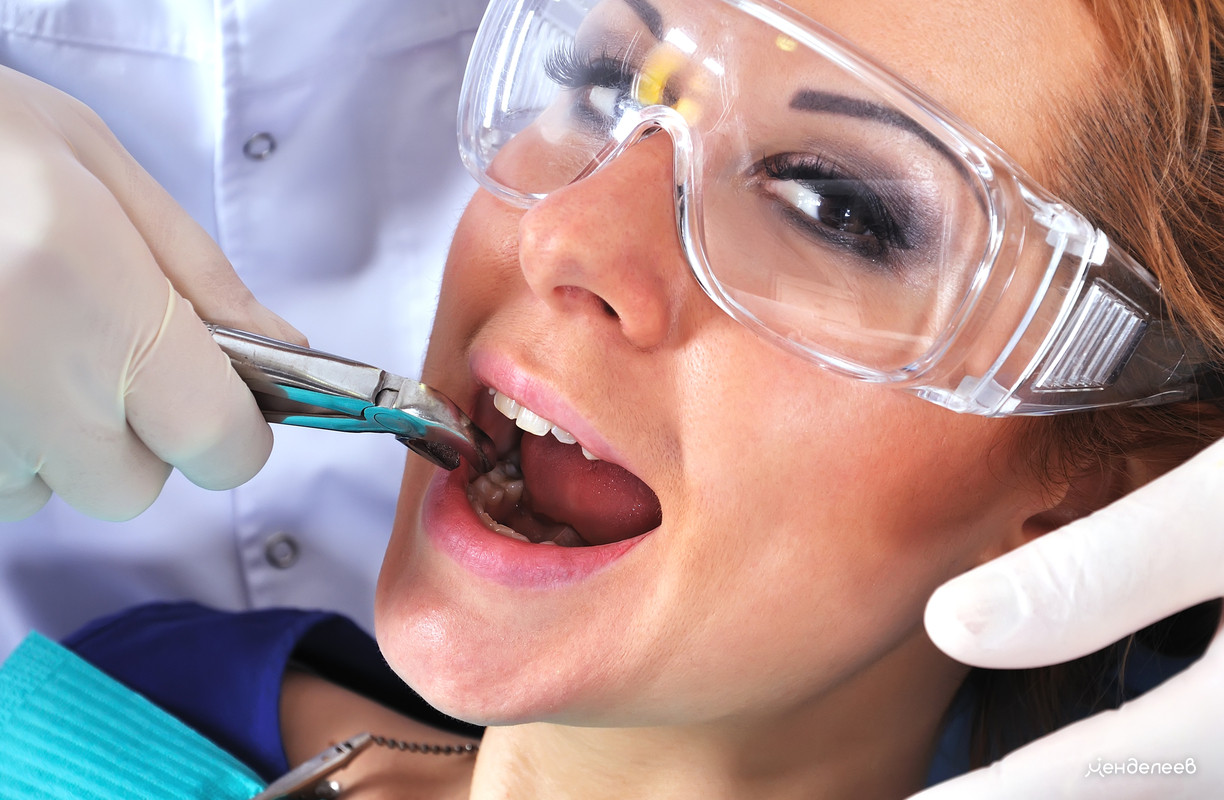 стоматолог удаляет пациентке зуб