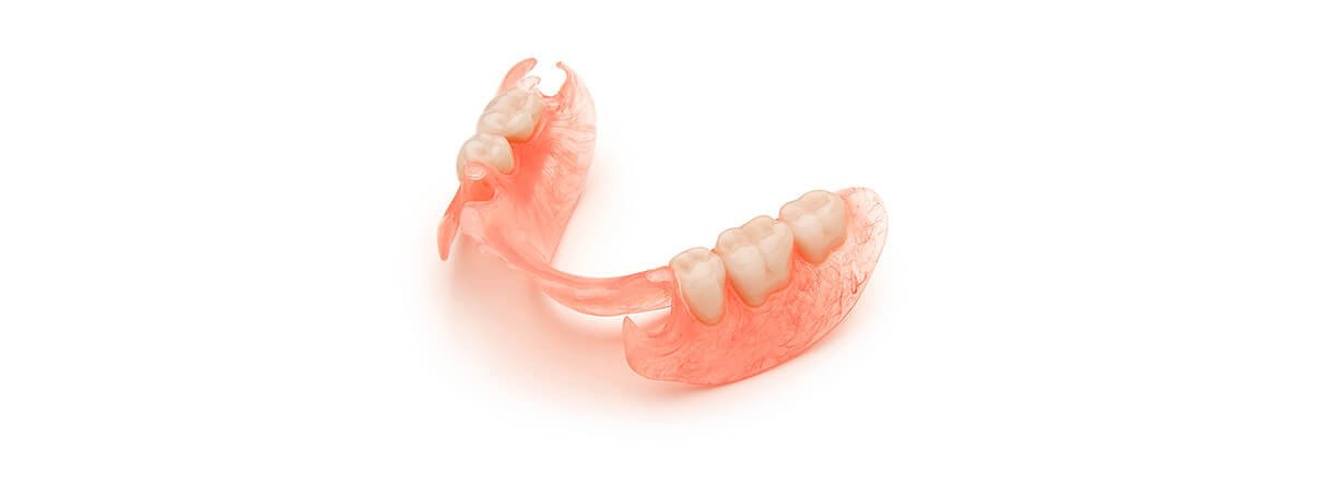 Протезирование зубов инвалидам 3 группы. Иммедиат протезы ортопедическая стоматология. Микропротез бабочка/ иммедиат-протез. Бабочка Квадротти протез. Полный съемный иммедиат-протез.